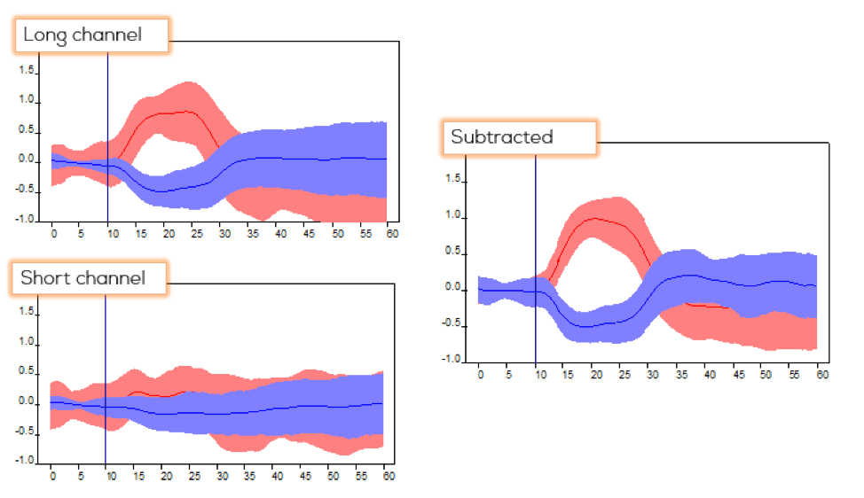 Figure 2: Reduction in physiological "noise" by subtracting short separation channel (extracerebral) data from long channel (extracerebral + intracerebral)